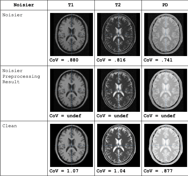 MRIImageProcessing